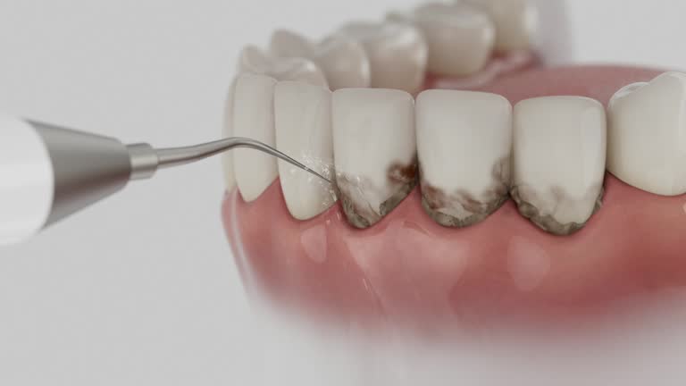 Reliable Dental Implants contractor in Spring Hill, FL by Smile Center Dentistry